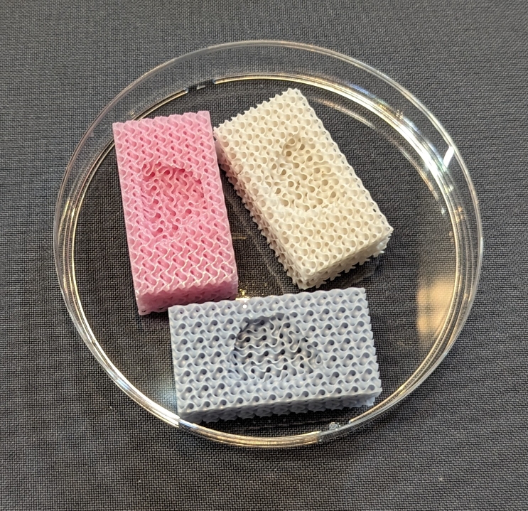 3D (bio) printing of customized scaffolds for tissue engineering