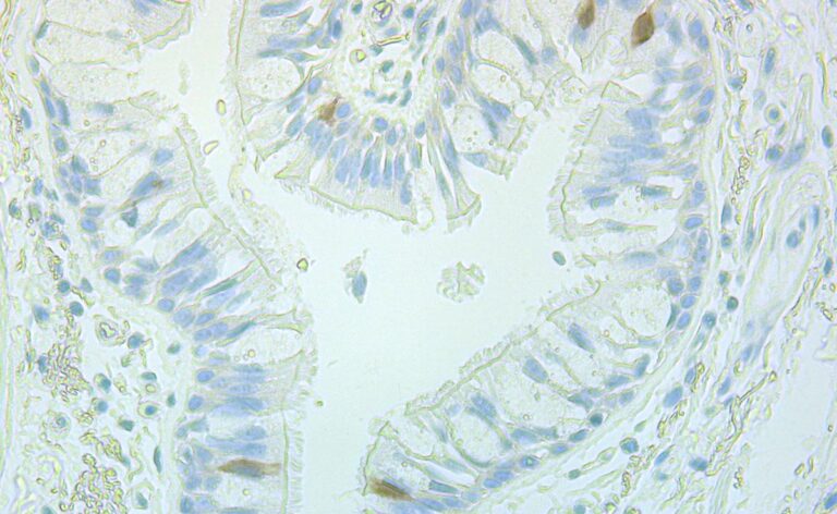 lung cell image sm1 768x472